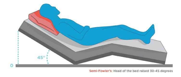 Best Sleeping Position For Blood Circulation 8 Diagram showing semi-Fowler sleeping position