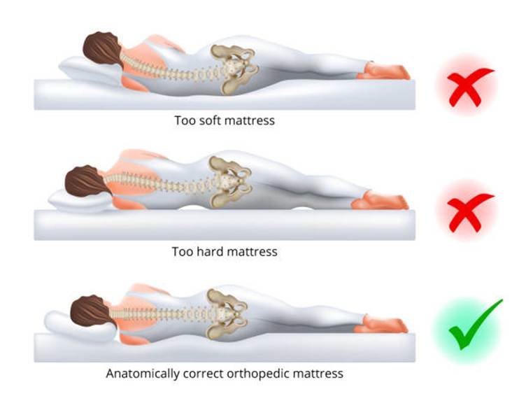 Soft vs. medium-firm vs. firm pelvis alignment